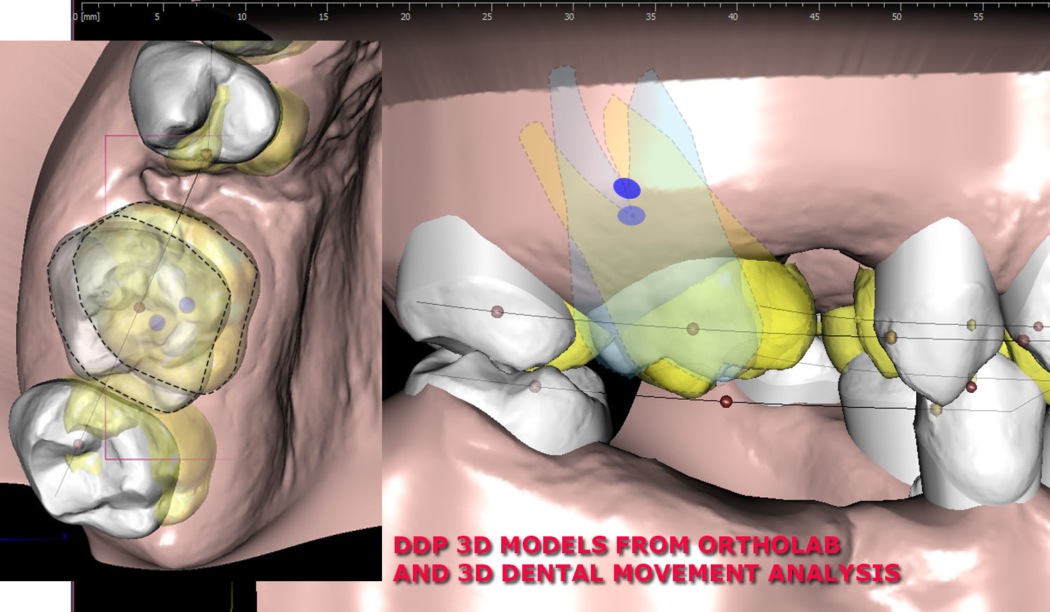 dma over digital models